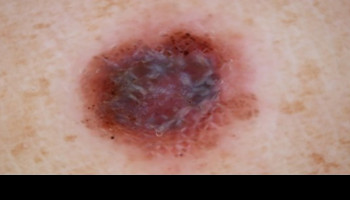 The Foundations of Skin Cancer Medicine