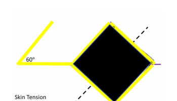 Rhomboid Flaps 1