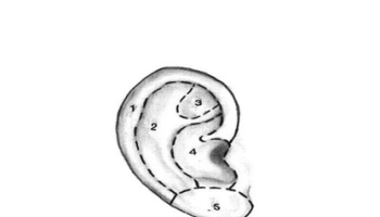 Ear Wedges
